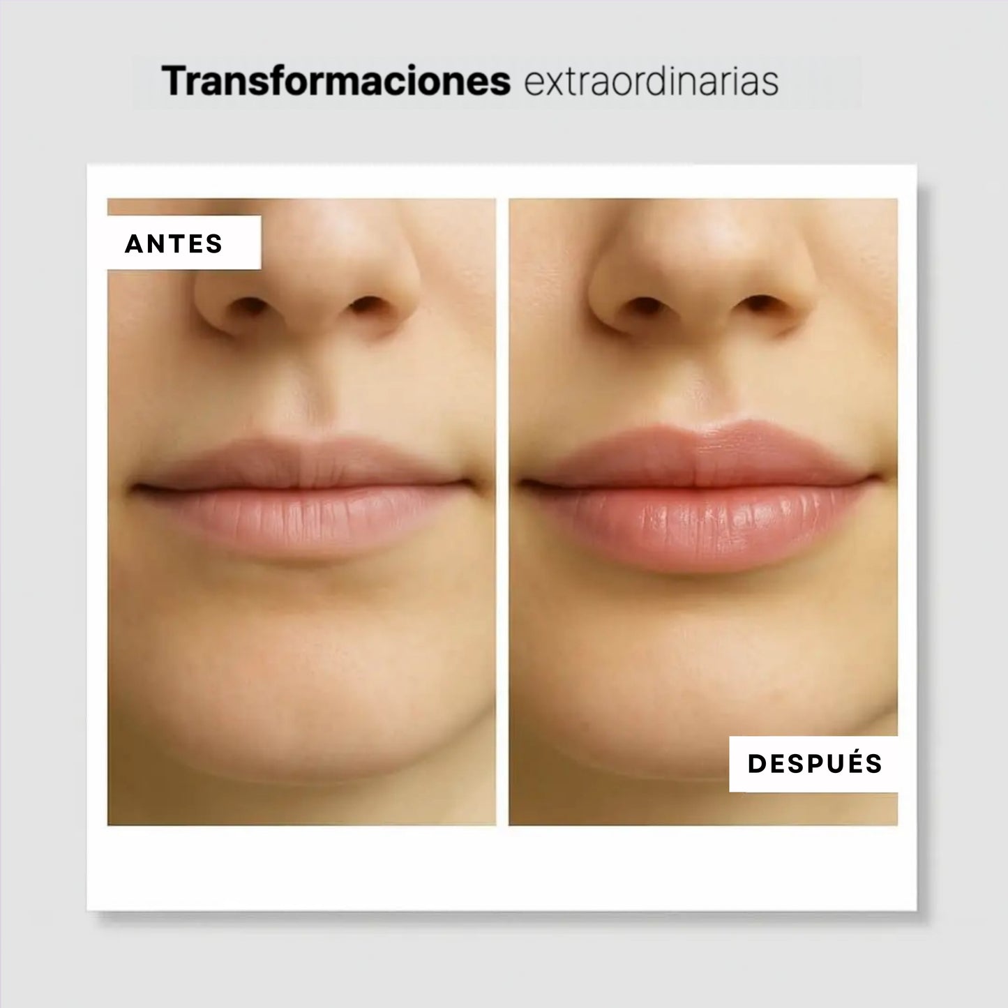 Kit de labios