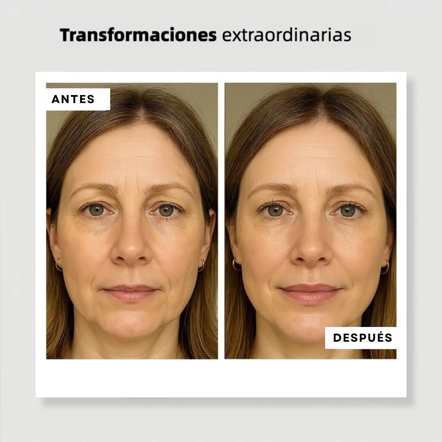 Kit de labios